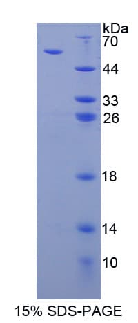 Human THBS3 / Thrombospondin 3 Protein (Recombinant His-GST-S)