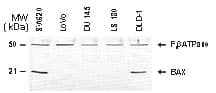 Polyclonal Rabbit anti-Human BAX Antibody (aa43-61, IHC, WB)