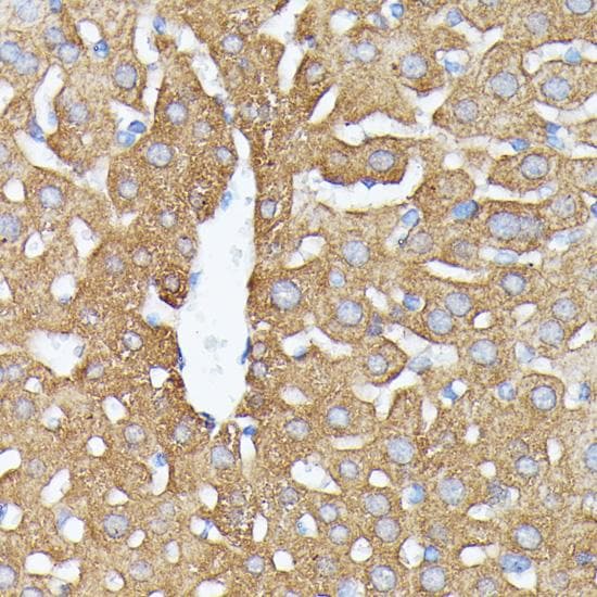 Polyclonal Rabbit anti-Human NBP / NUBP1 Antibody (IHC)