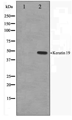 KRT19 / CK19 / Cytokeratin 19 Antibody