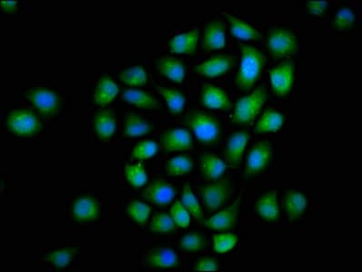 MTMR2 Antibody