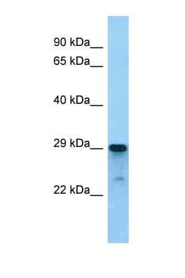 Polyclonal Rabbit anti-Mouse ARGLU1 Antibody (N-Terminus, WB)