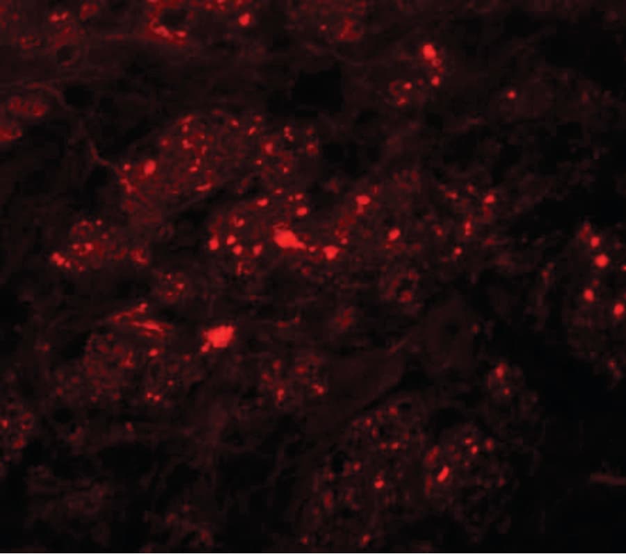 TMEM192 Antibody