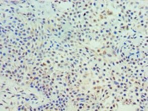 Polyclonal Rabbit anti-Human TK1 / TK / Thymidine Kinase Antibody (aa1-234, IHC)