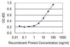 Monoclonal Mouse anti-Human ATP6V1B1 Antibody (clone 3G11)