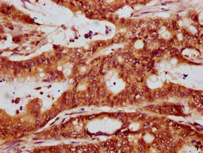 Polyclonal Rabbit anti-Human HIST1H4I Antibody (IHC)