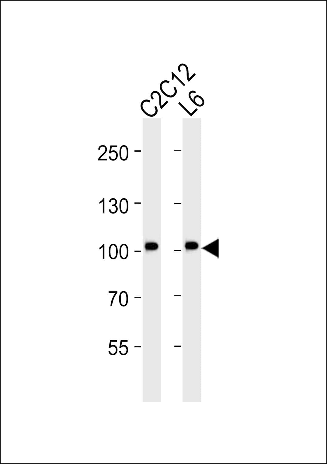 MUSK Antibody (clone 1429CT456.173.44)