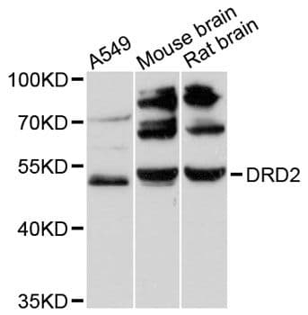 DRD2 / Dopamine Receptor D2 Antibody