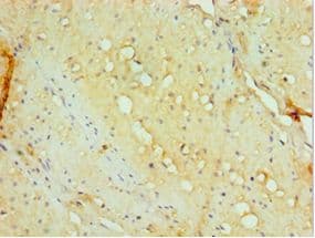 IHC-plus™ Polyclonal Rabbit anti-Human AHSP / EDRF Antibody (aa1-102, IHC)