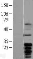 BCL2L1 / BCL-XL Protein (Over-Expression Lysate Myc-DDK (Flag))