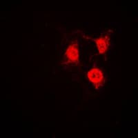 CDK2 Antibody (C-Terminus)