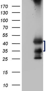 Monoclonal Mouse anti-Human TARBP2 / TRBP2 Antibody (clone OTI2C12, IHC, WB)
