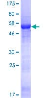 Human CDCA4 Protein (Recombinant GST)