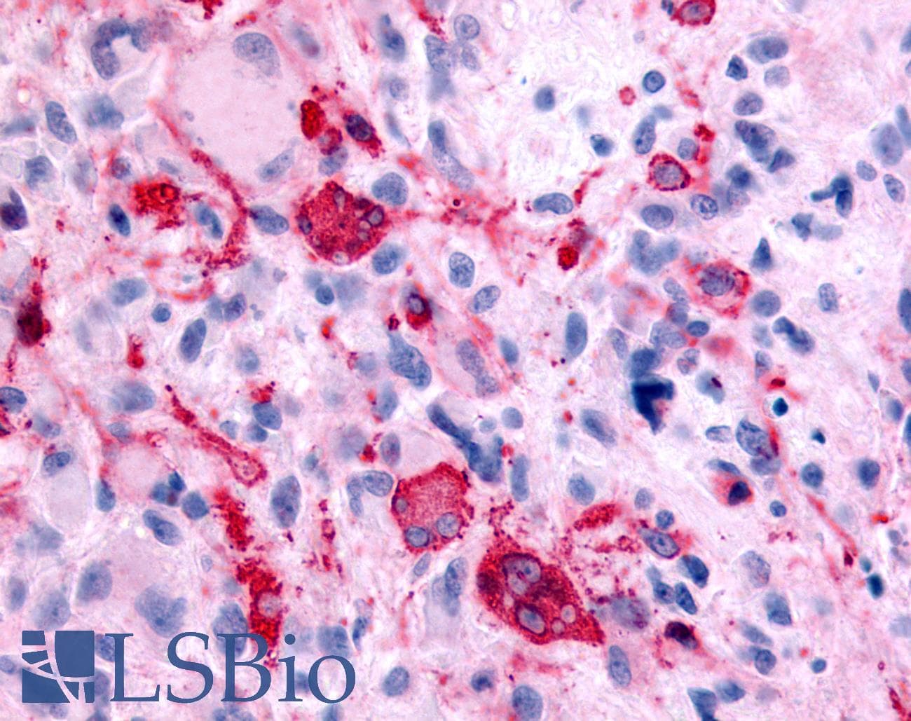 PathPlus™ GABBR1 / GABA B Receptor 1 Antibody (N-Terminus)
