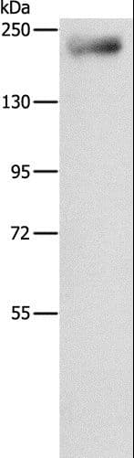 Polyclonal Rabbit anti-Human IQGAP3 Antibody (WB)