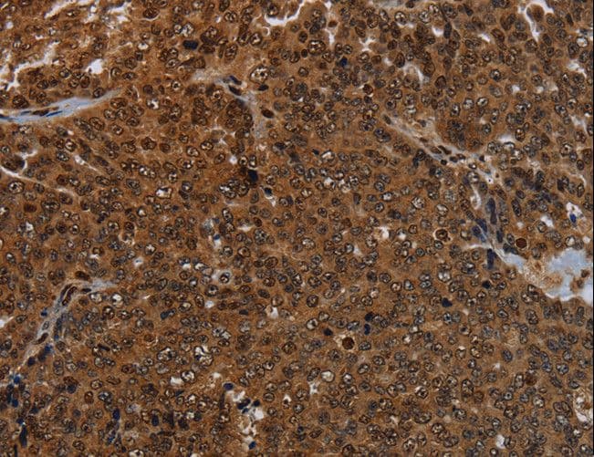 Polyclonal Rabbit anti-Human KDM4B / JMJD2B Antibody (IHC)