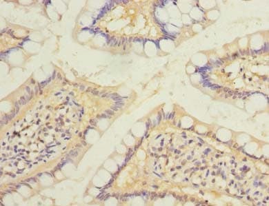 Polyclonal Rabbit anti-Human RAB6B Antibody (IHC, WB)