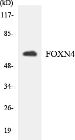 Polyclonal Rabbit anti-Human FOXN4 Antibody (aa397-446, WB)