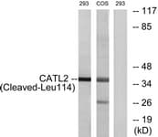 PathPlus™ Polyclonal Rabbit anti-Human CTSV / Cathepsin V Antibody (aa95-144, IHC, WB)