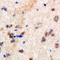 PSPH Antibody