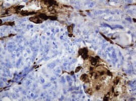 TP / Thymidine Phosphorylase Antibody (clone OTI1H7)
