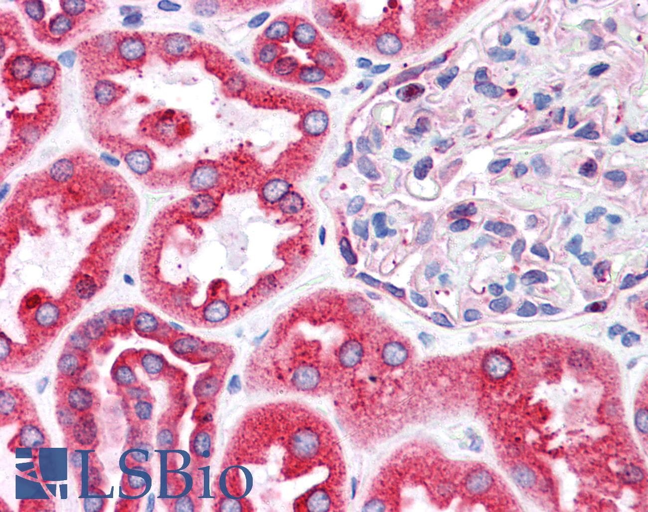 IHC-plus™ BCAP31 / BAP31 Antibody (aa301-313)