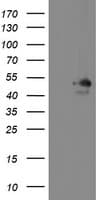MEIS3 Antibody (aa1-261, clone OTI3E12, Carrier-free)