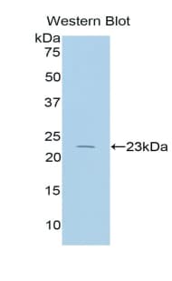 IL17RB Antibody (aa166-354)