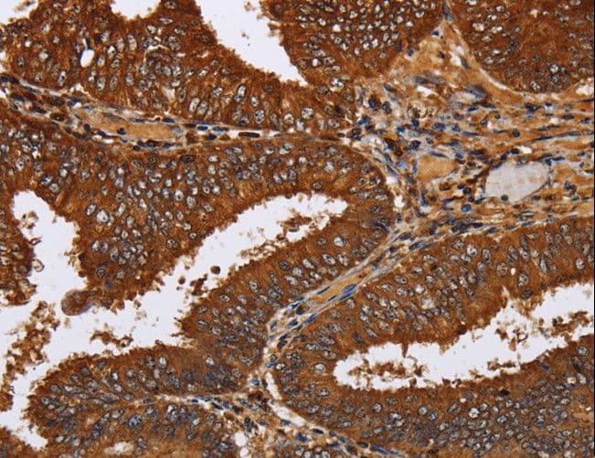 TICAM2 / TRAM Antibody