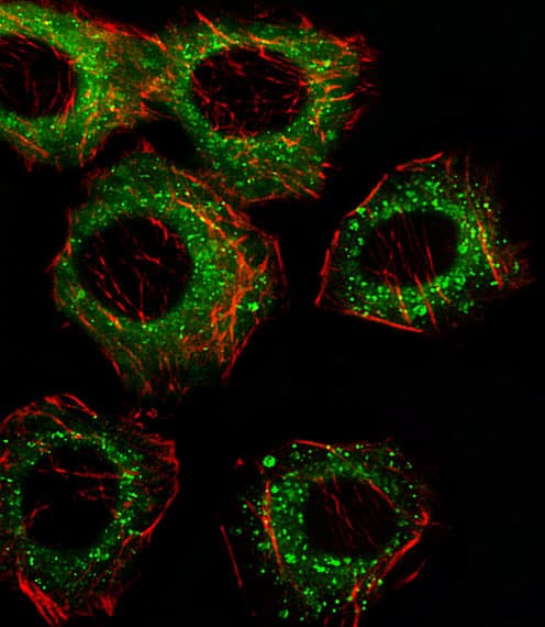 Delta-6 Desaturase / FADS2 Antibody (aa79-108)