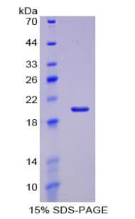 Human ACAN / Aggrecan Protein (Recombinant His)