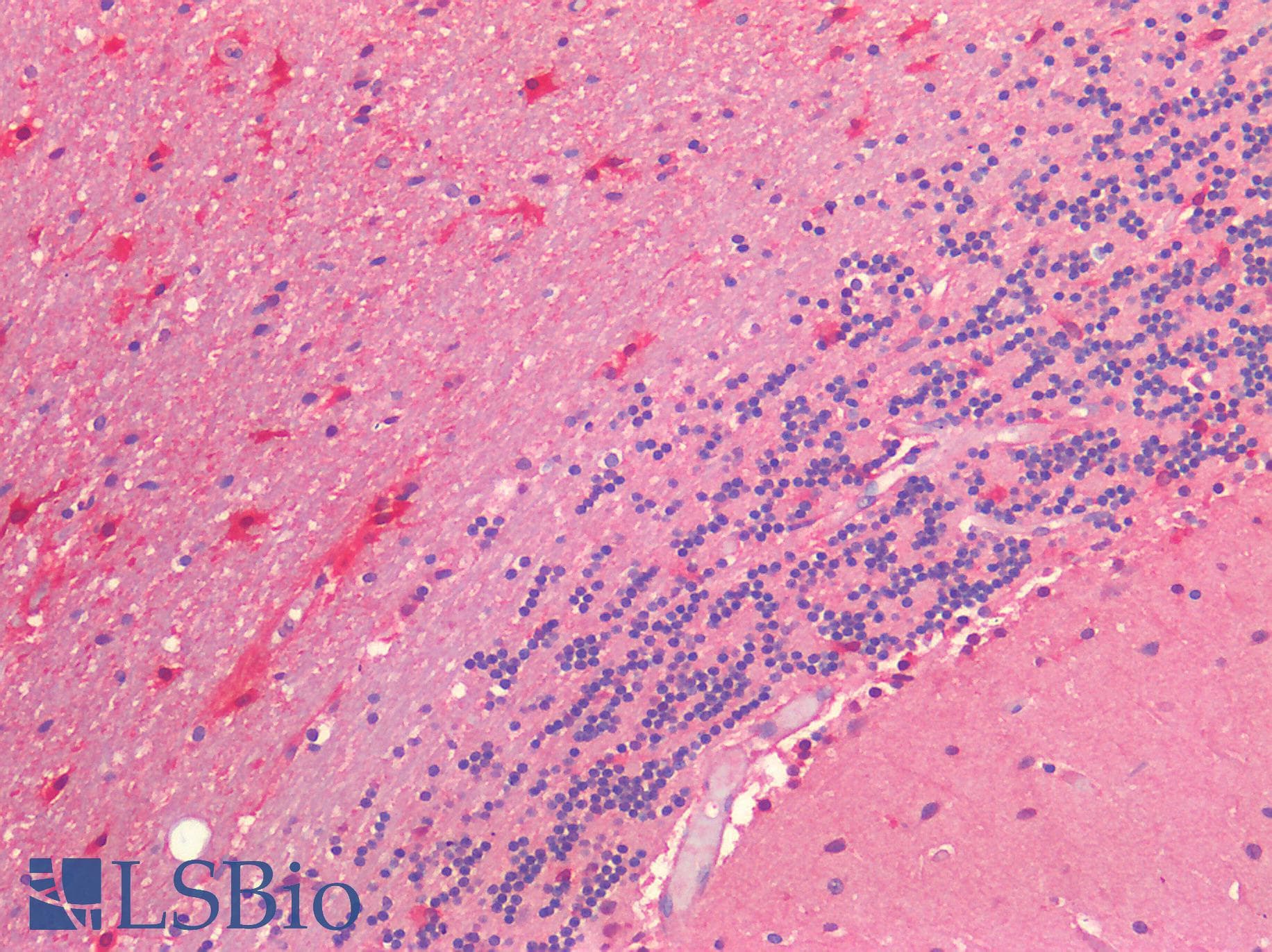 IHC-plus™ Polyclonal Rabbit anti-Human NRN1 / Neuritin Antibody (IHC)