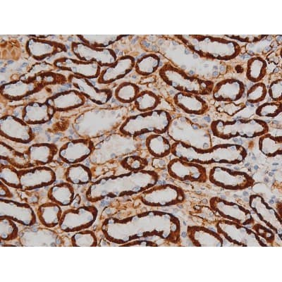 CREB1 / CREB Antibody (phospho-Ser142)