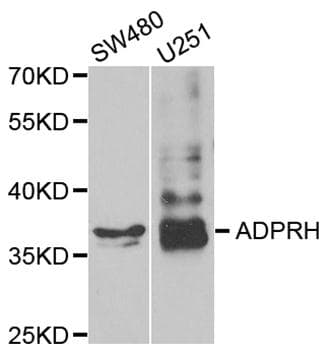 Polyclonal Rabbit anti-Human ADPRH / ARH1 Antibody (IHC, WB)