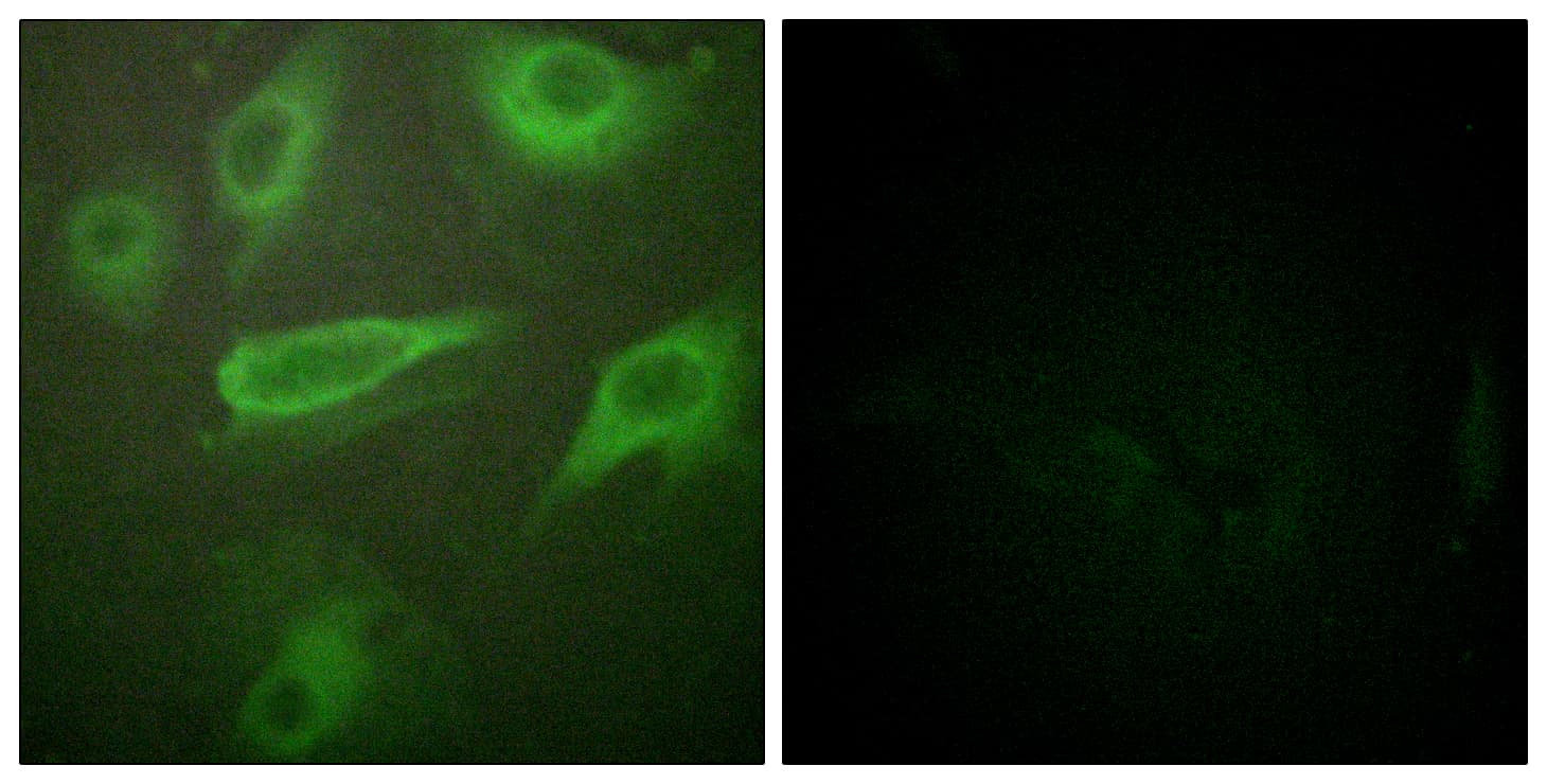 Polyclonal Rabbit anti-Human IL4R / CD124 Antibody (phospho-Tyr497, IF, WB)