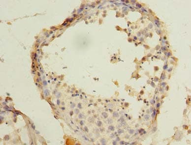 ARPM1 Antibody
