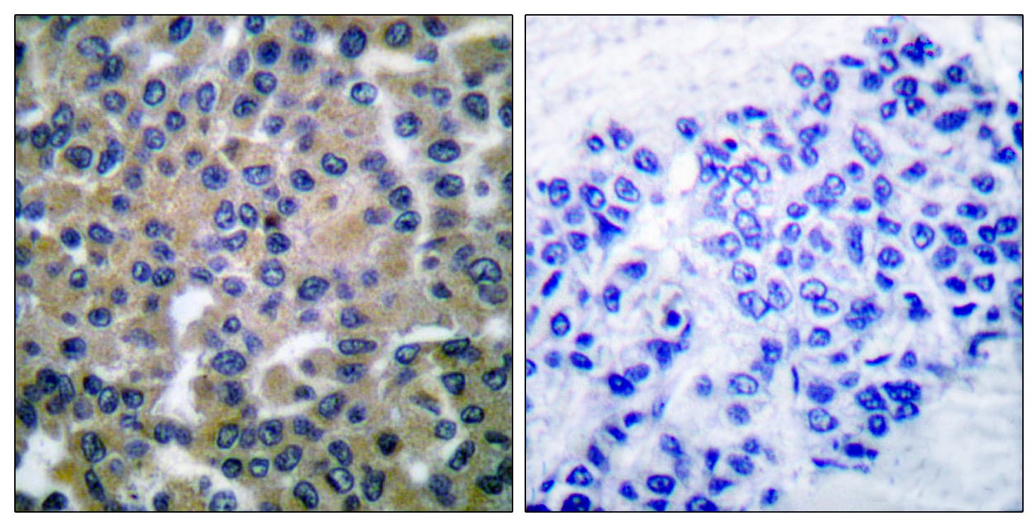 SYK Antibody (aa314-363)