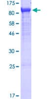 Human GLCNE / GNE Protein (Recombinant GST)