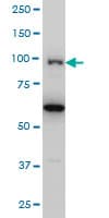 IHC-plus™ Monoclonal Mouse anti-Human OCRL Antibody (clone 4A6, IHC, WB)