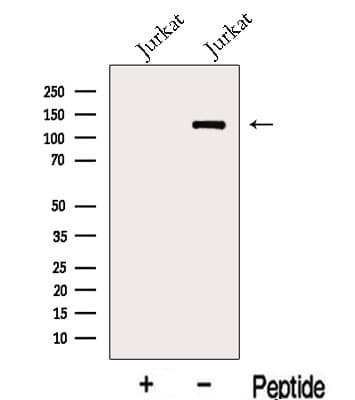 JHDM1A / KDM2A Antibody