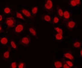 FOSL2 / FRA-2 Antibody