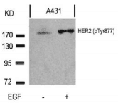 ERBB2 / HER2 Antibody