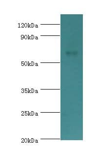 CHRM3 / M3 Antibody (aa270-470)