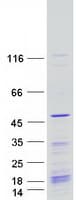 Human KIN17 / KIN Protein (Recombinant Myc-DDK (Flag))