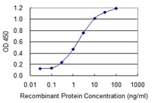 UTRN / Utrophin Antibody (clone 5G6)