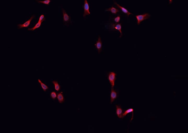 Polyclonal Rabbit anti-Human ZRANB2 / ZNF265 Antibody (IF, WB)