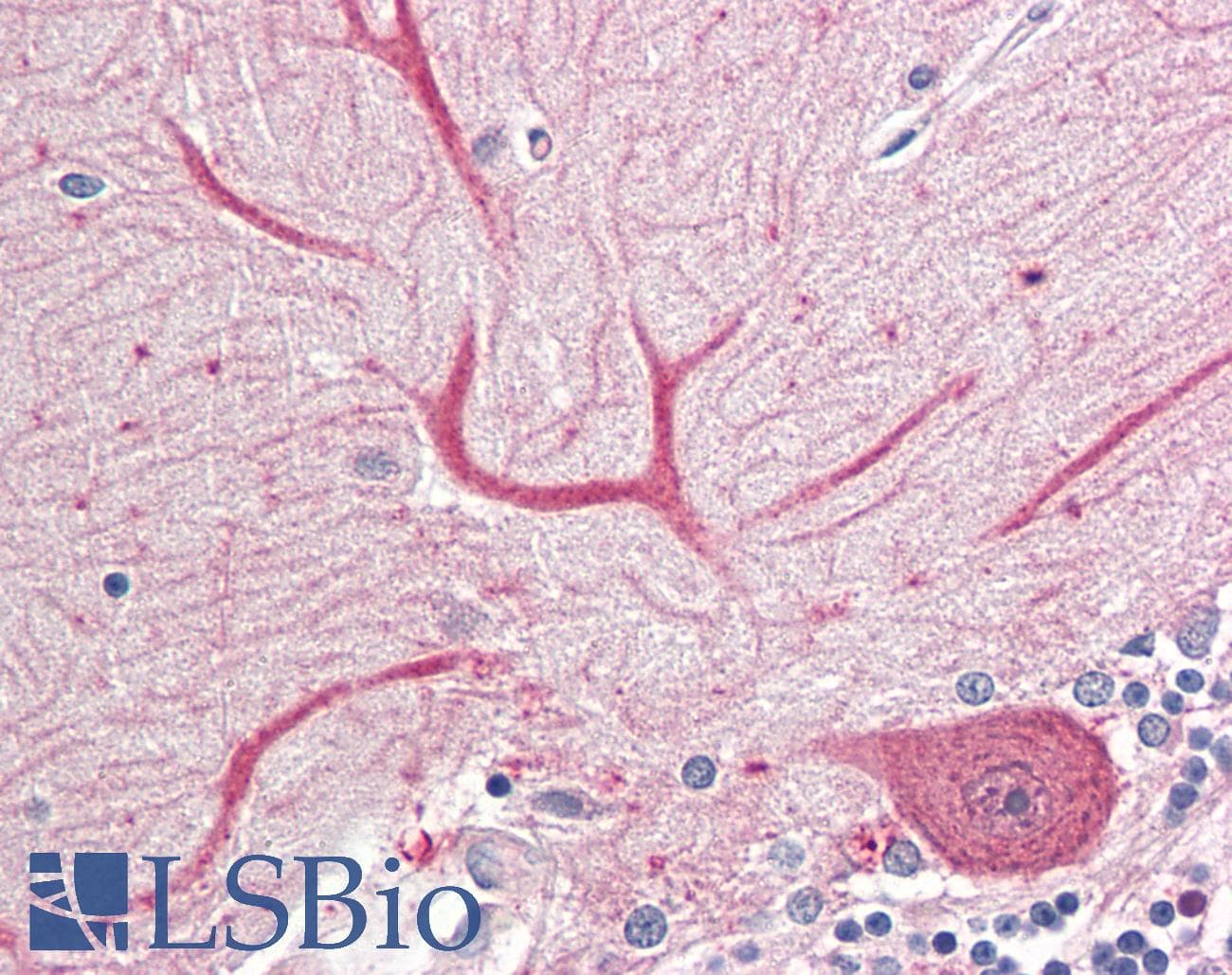 IHC-plus™ KEAP1 Antibody (aa41-53)