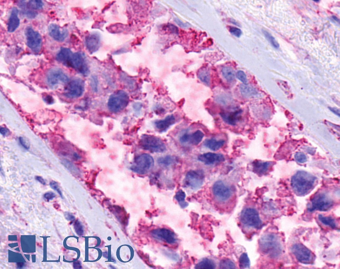 PathPlus™ Polyclonal Rabbit anti-Human ADGRF5 / GPR116 Antibody (Cytoplasmic Domain, IHC)