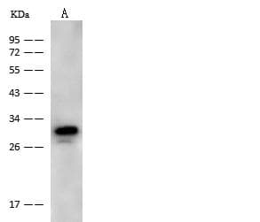 NMRAL1 / HSCARG Antibody