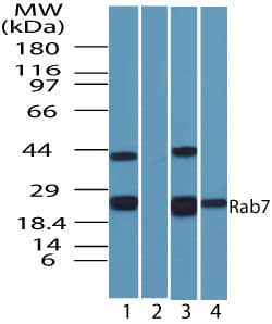 IHC-plus™ Polyclonal Rabbit anti-Human RAB7A / RAB7 Antibody (aa90-140, IHC, WB)